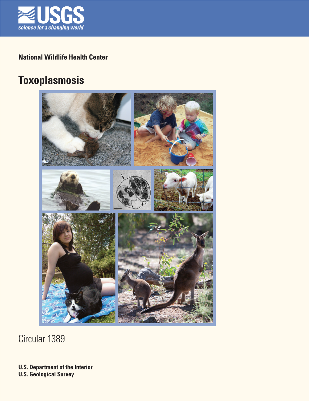 Toxoplasmosis