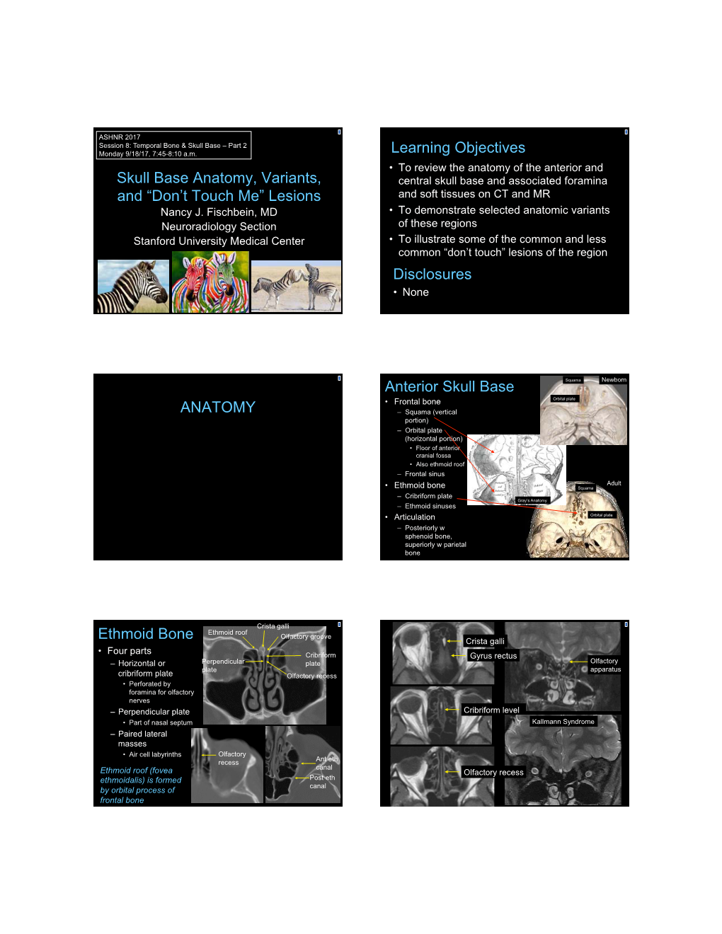 Skull Base Anatomy, Variants, Central Skull Base and Associated Foramina and “Don’T Touch Me” Lesions and Soft Tissues on CT and MR Nancy J