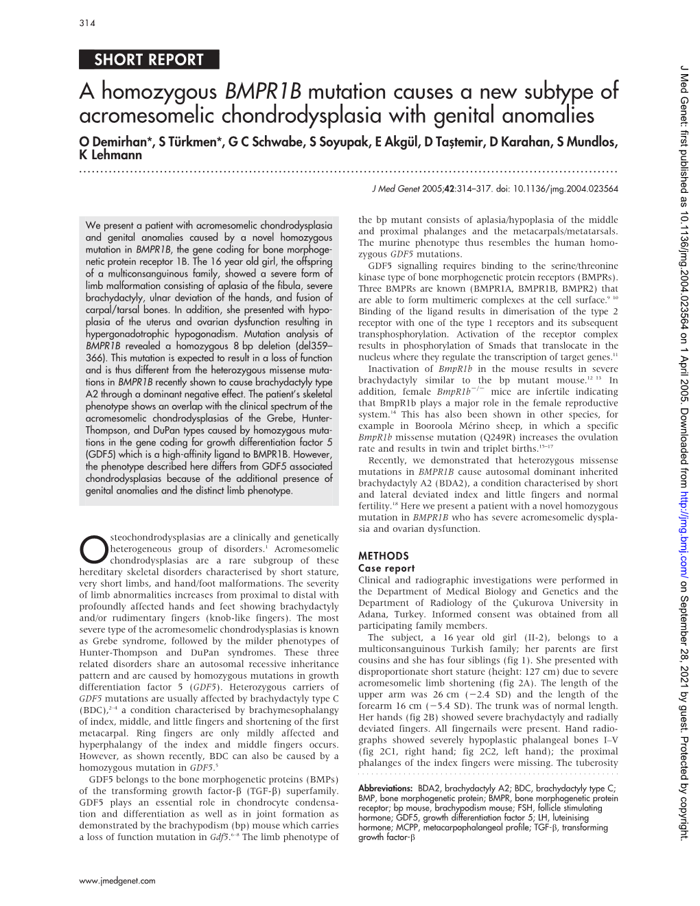 A Homozygous BMPR1B Mutation Causes a New Subtype Of