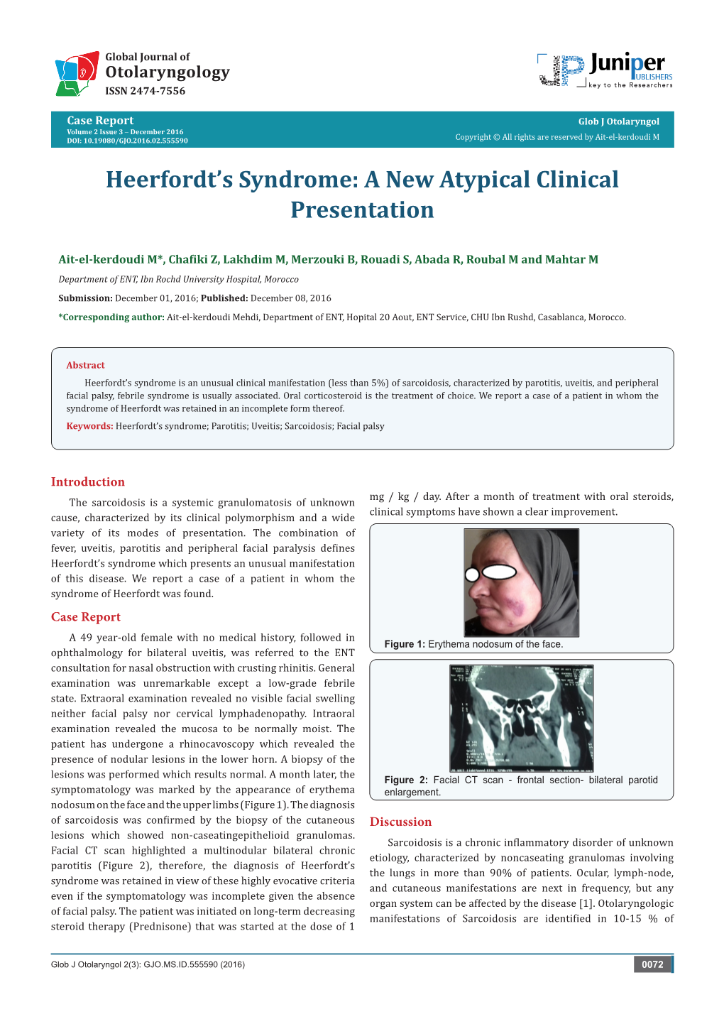 Heerfordt's Syndrome: a New Atypical Clinical Presentation