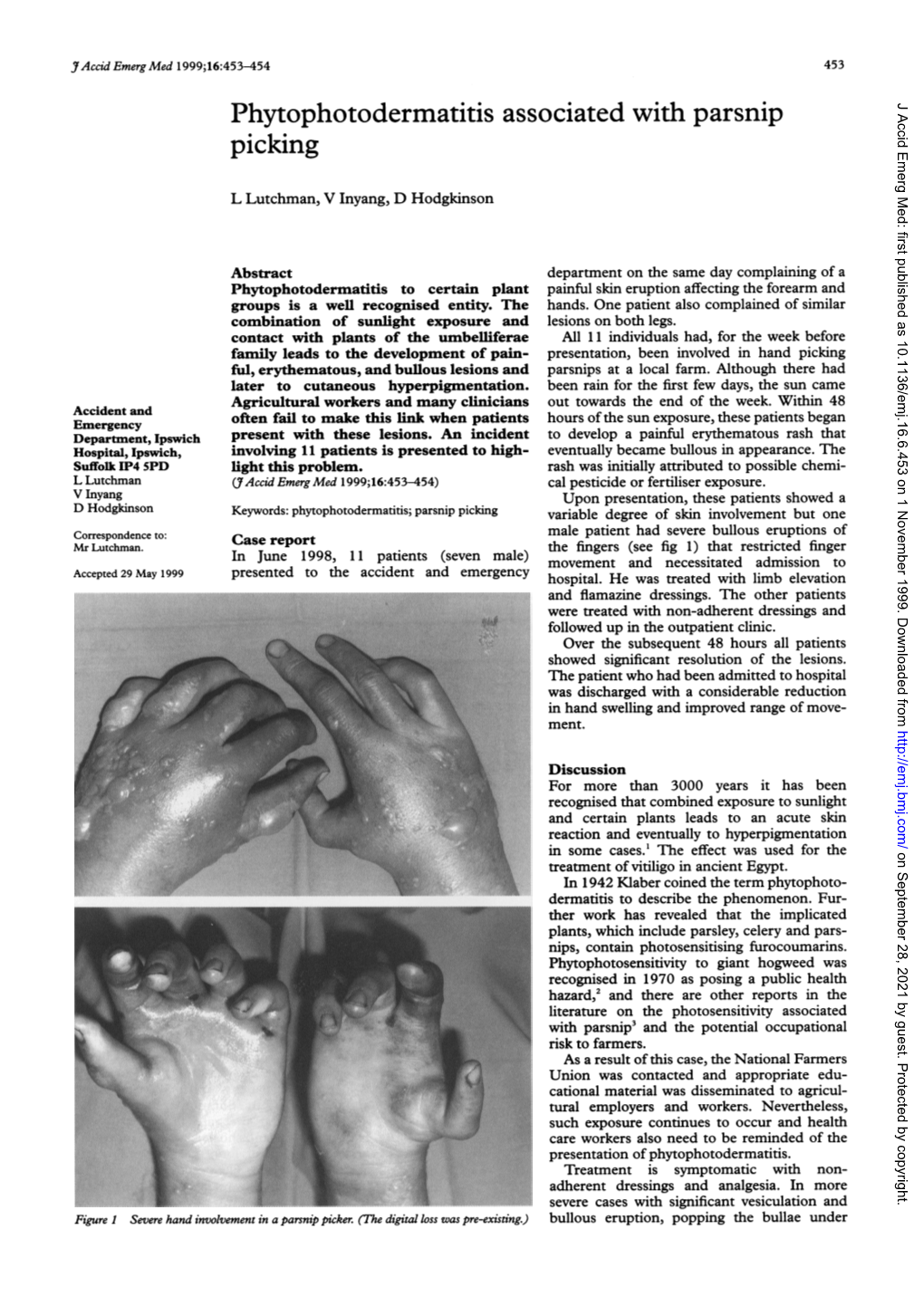 Phytophotodermatitis Associated with Parsnip J Accid Emerg Med: First Published As 10.1136/Emj.16.6.453 on 1 November 1999