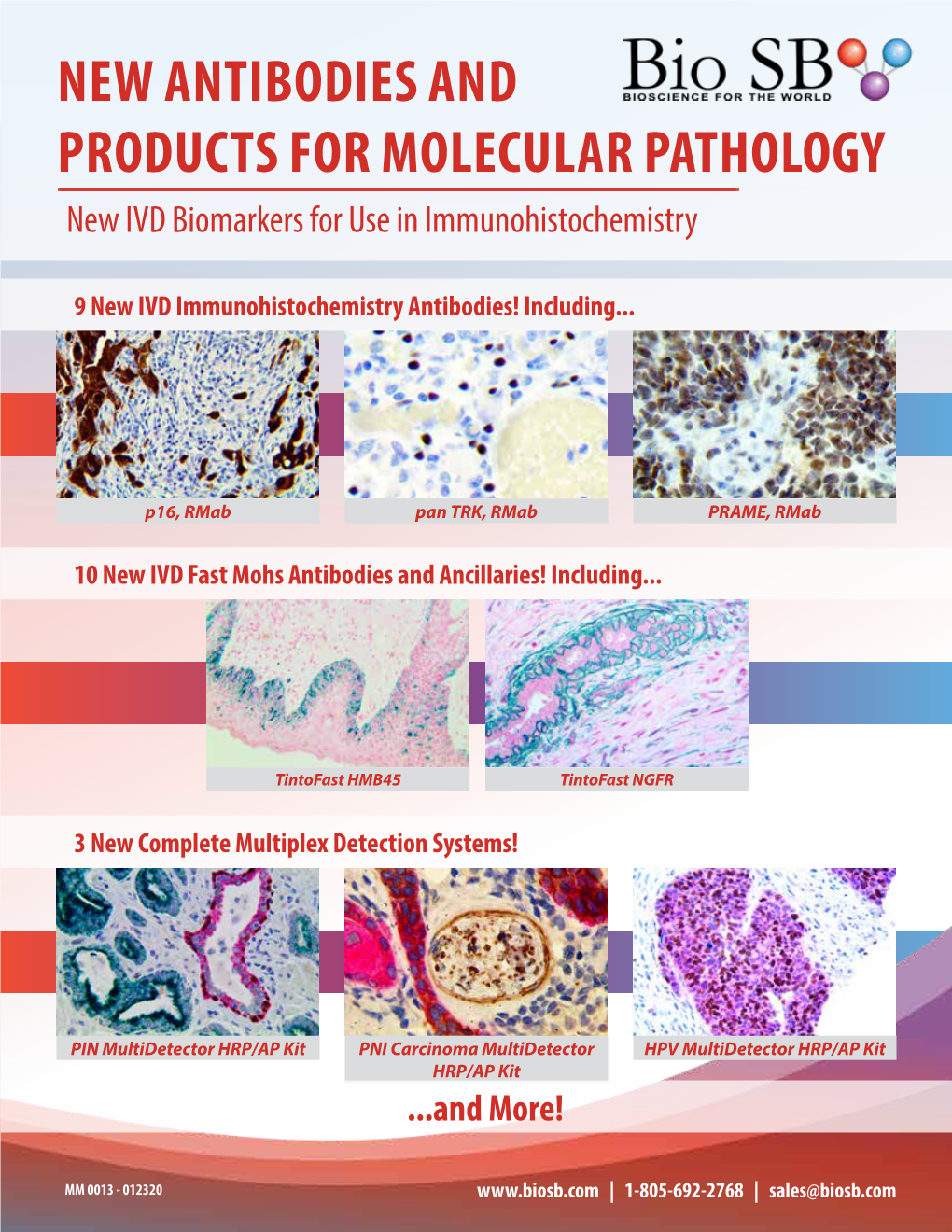 NEW ANTIBODIES and PRODUCTS for MOLECULAR PATHOLOGY New IVD Biomarkers for Use in Immunohistochemistry