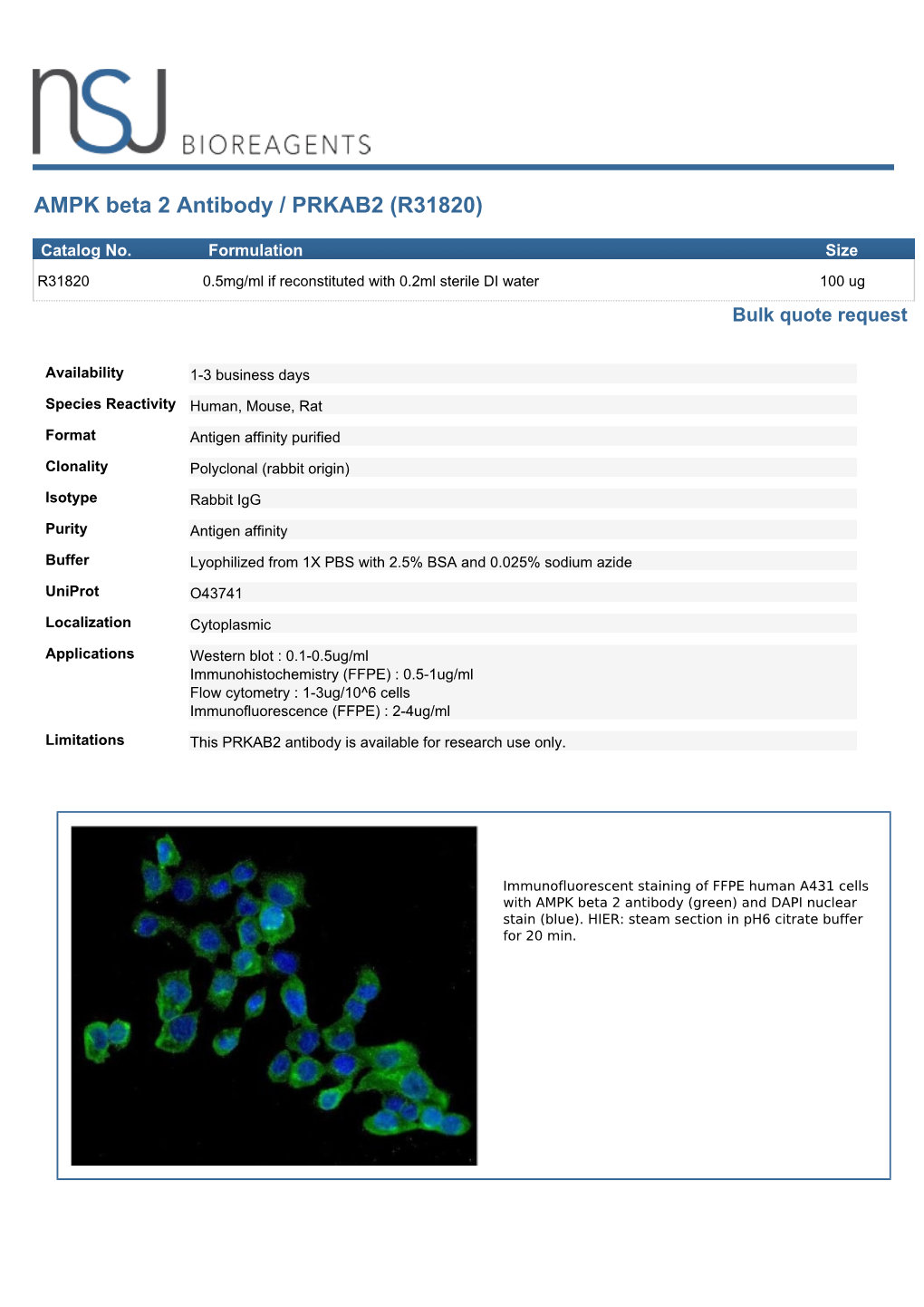 AMPK Beta 2 Antibody / PRKAB2 (R31820)