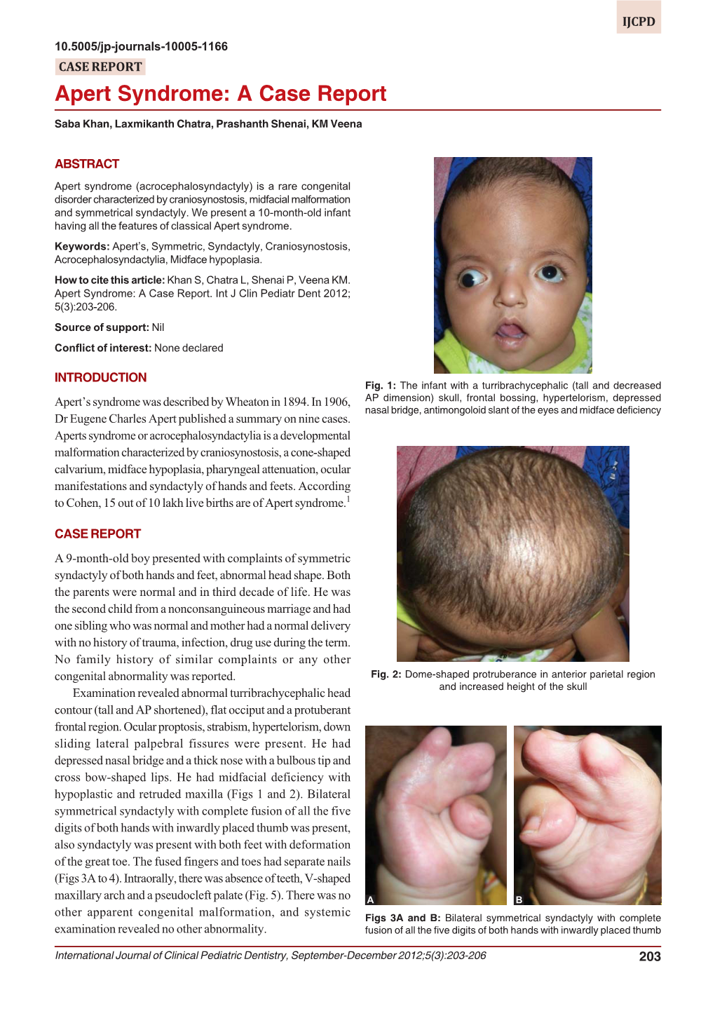 Apert Syndrome: a Case Report Apert Syndrome: a Case Report