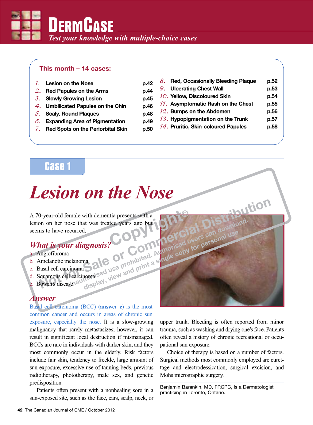 Lesion on the Nose P.42 8
