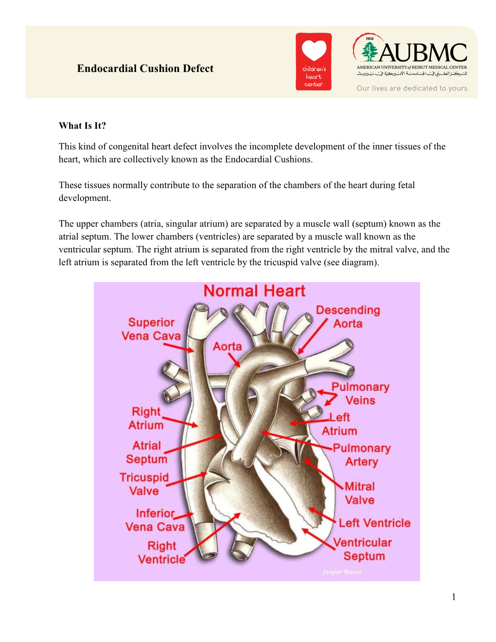 Endocardial Cushion Defect