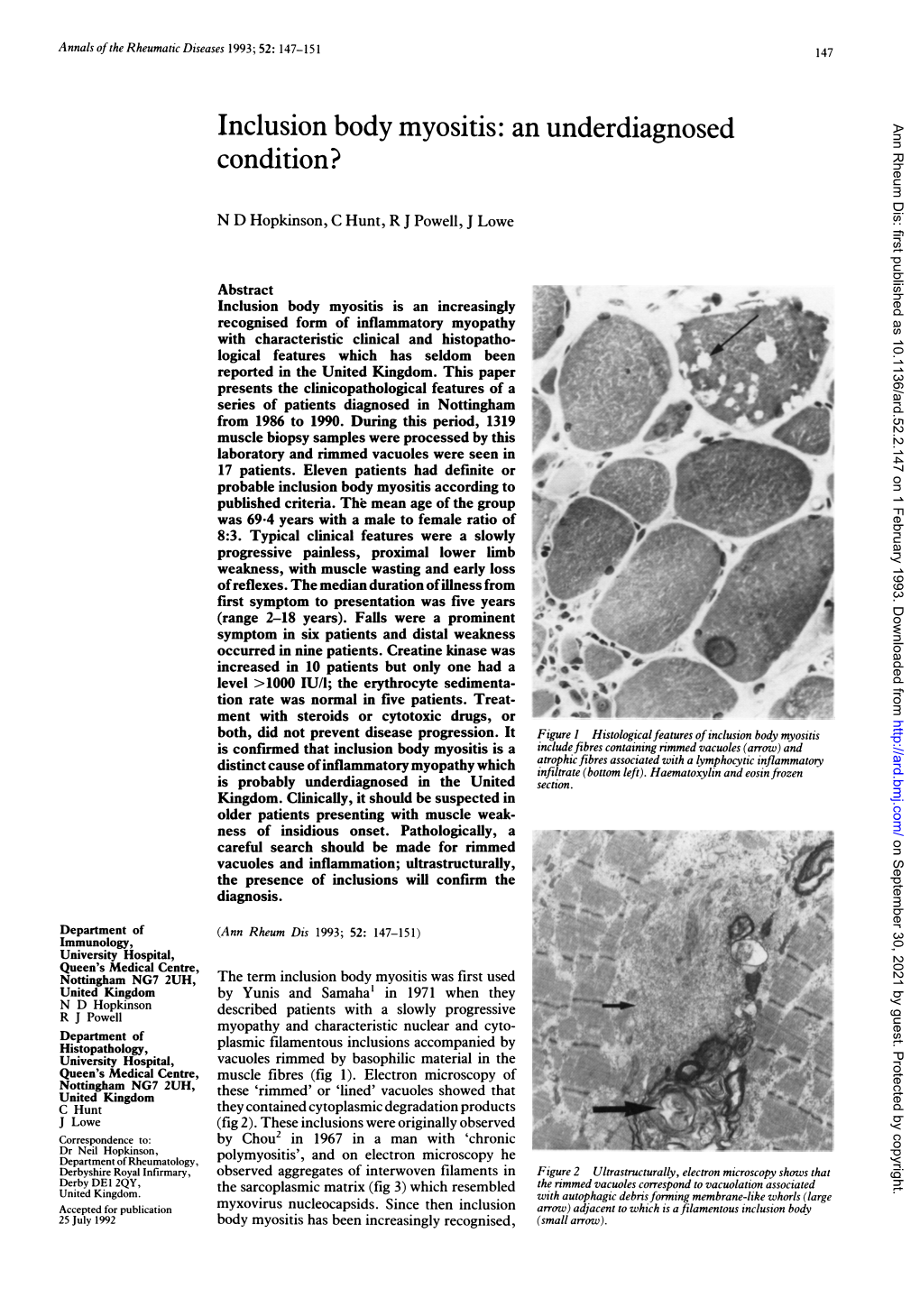 Inclusion Body Myositis: an Underdiagnosed Ann Rheum Dis: First Published As 10.1136/Ard.52.2.147 on 1 February 1993