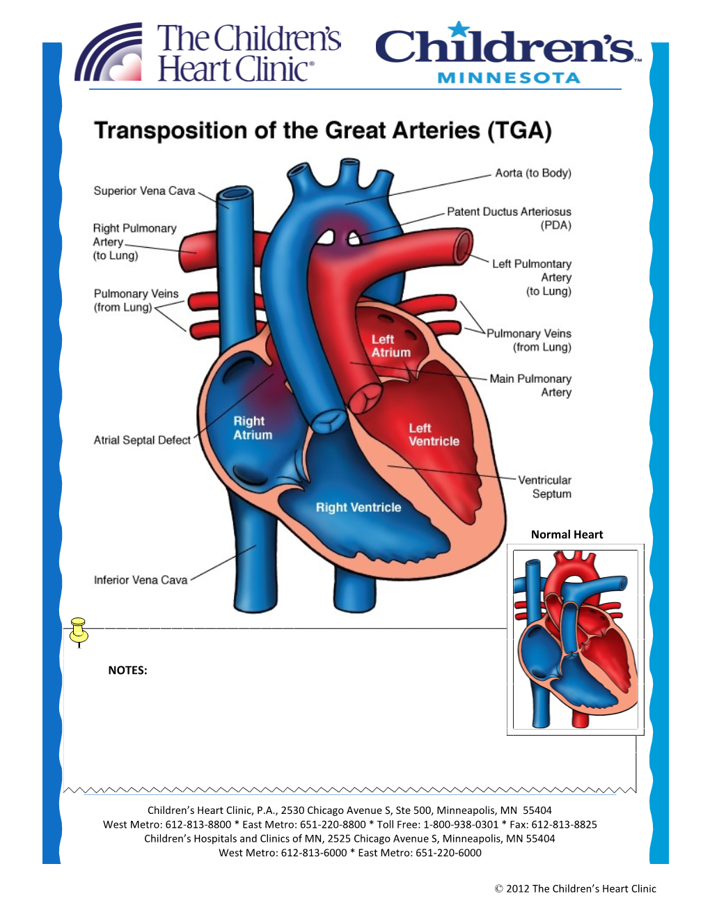 Transposition of the Great Arteries (D-TGA)