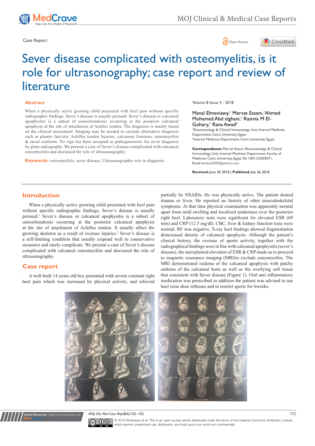 Sever Disease Complicated with Osteomyelitis, Is It Role for Ultrasonography; Case Report and Review of Literature