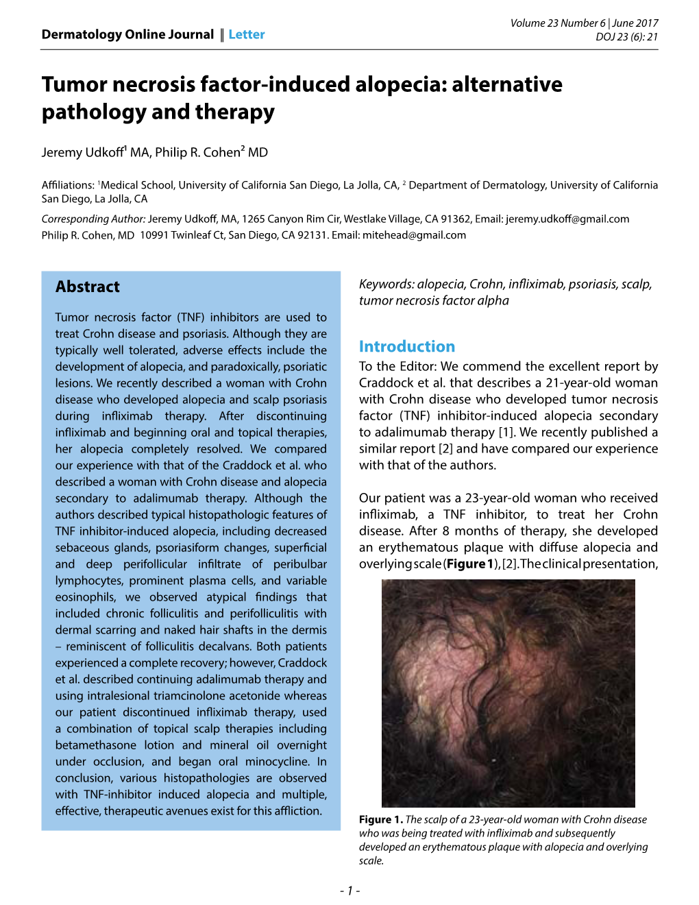 Tumor Necrosis Factor-Induced Alopecia: Alternative Pathology and Therapy