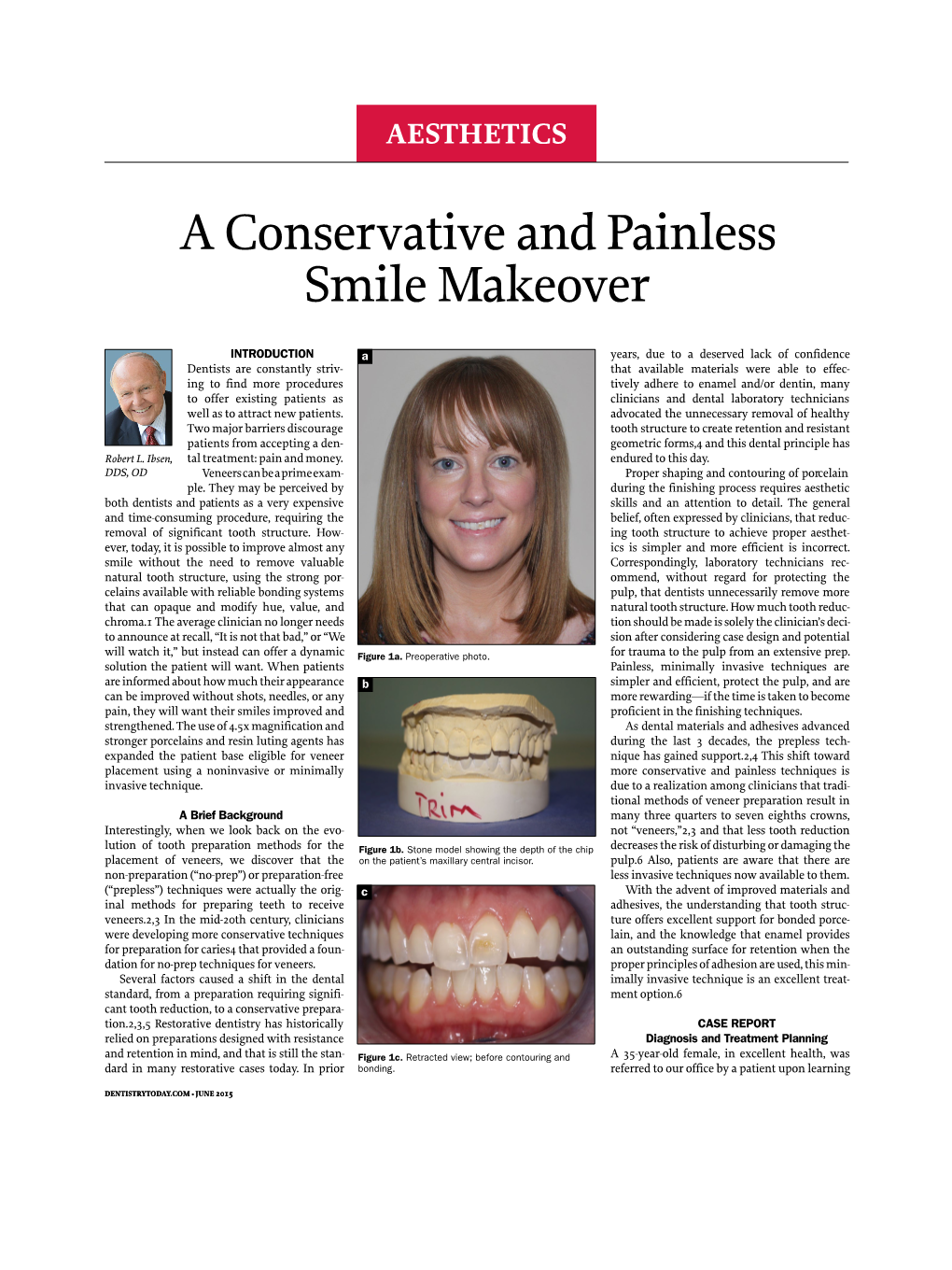 A Conservative and Painless Smile Makeover