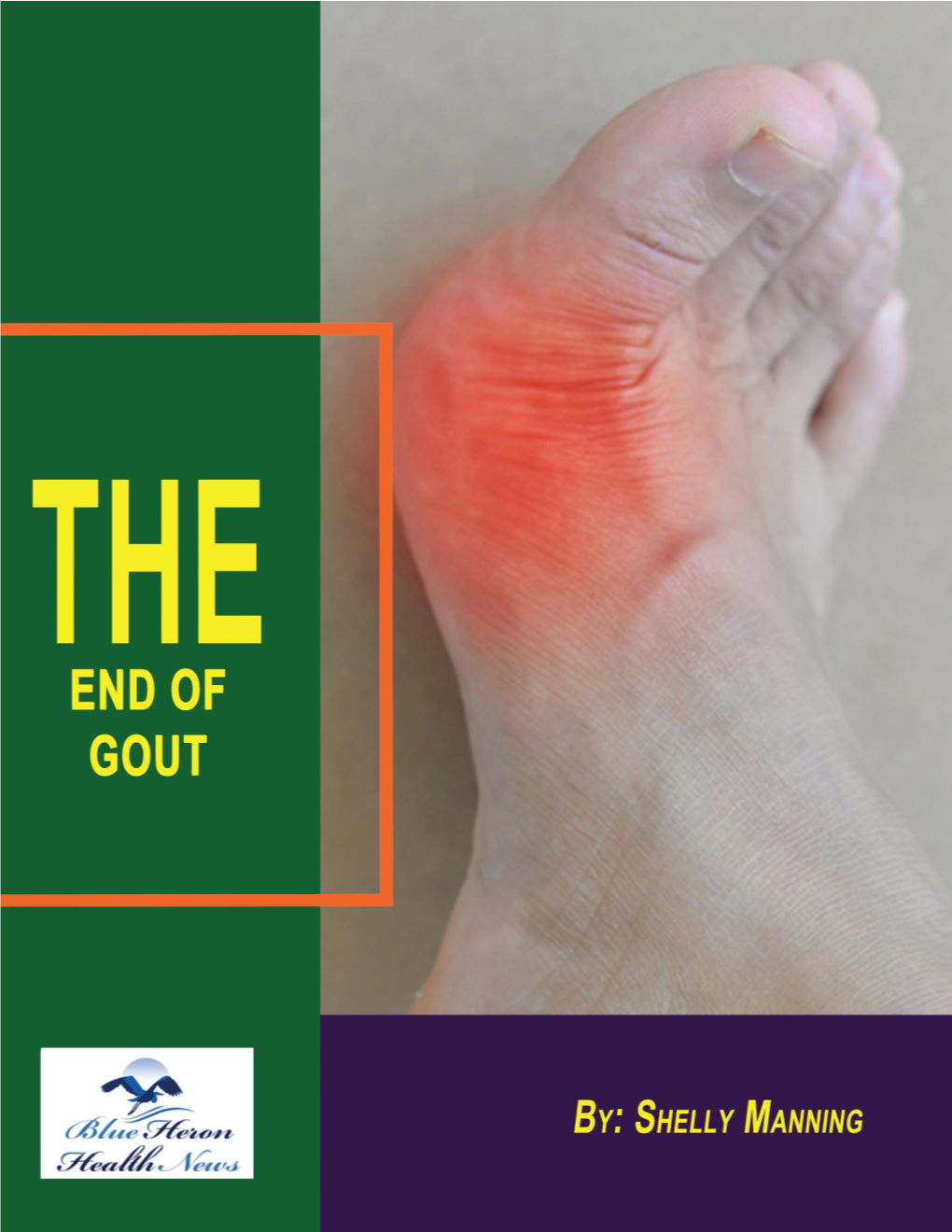 The End of Gout- a Comprehensive Peasant’S Guide to Dealing with the “Disease of Kings”