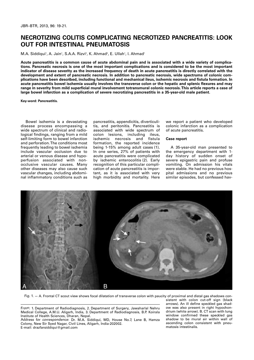 Necrotizing Colitis Complicating Necrotized Pancreatitis: Look out for Intestinal Pneumatosis
