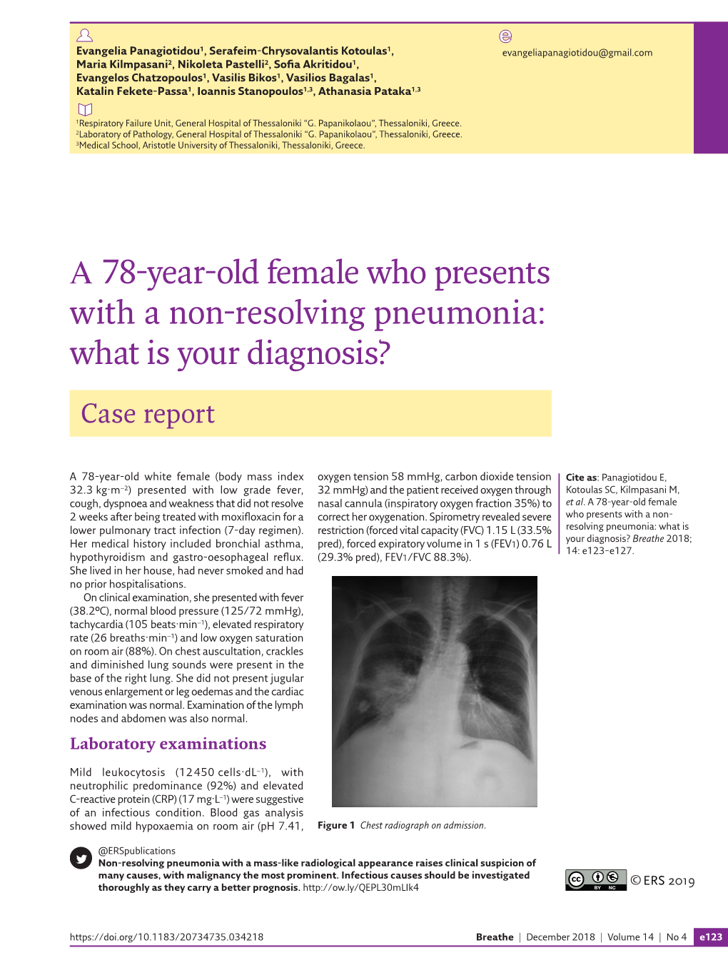 Α 78-Year-Old Female Who Presents with a Non-Resolving Pneumonia: What Is Your Diagnosis?