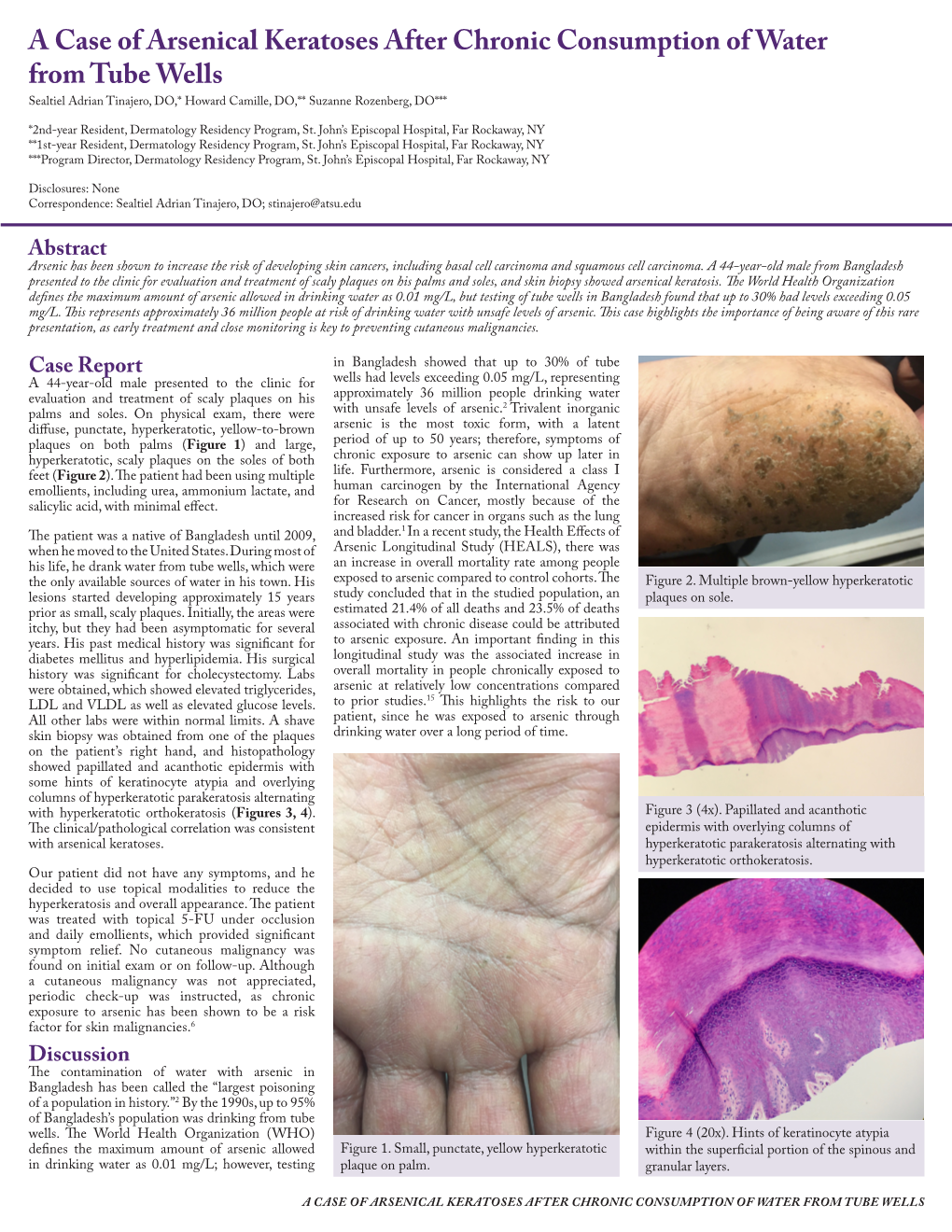 A Case of Arsenical Keratoses After Chronic Consumption of Water from Tube Wells Sealtiel Adrian Tinajero, DO,* Howard Camille, DO,** Suzanne Rozenberg, DO***