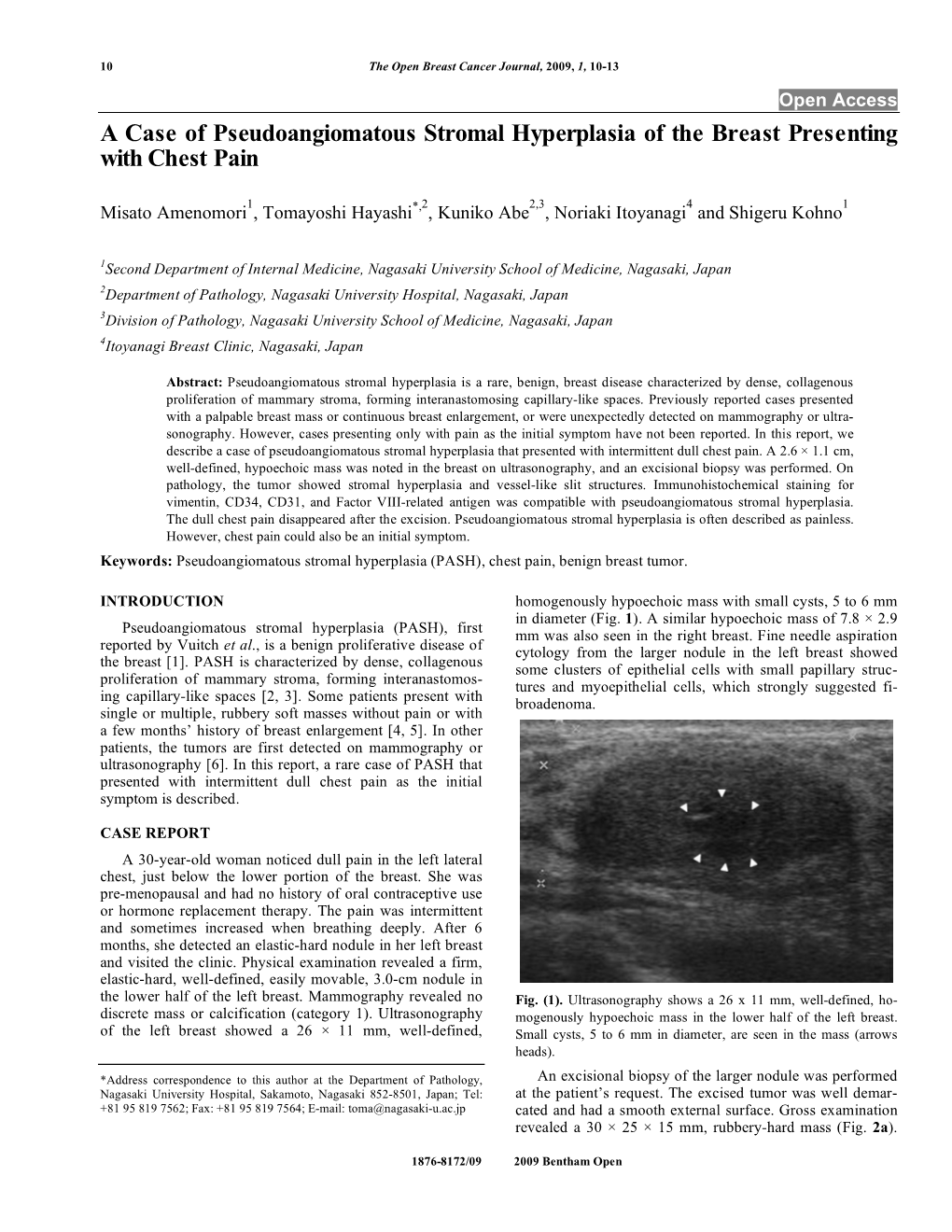 A Case of Pseudoangiomatous Stromal Hyperplasia of the Breast Presenting with Chest Pain