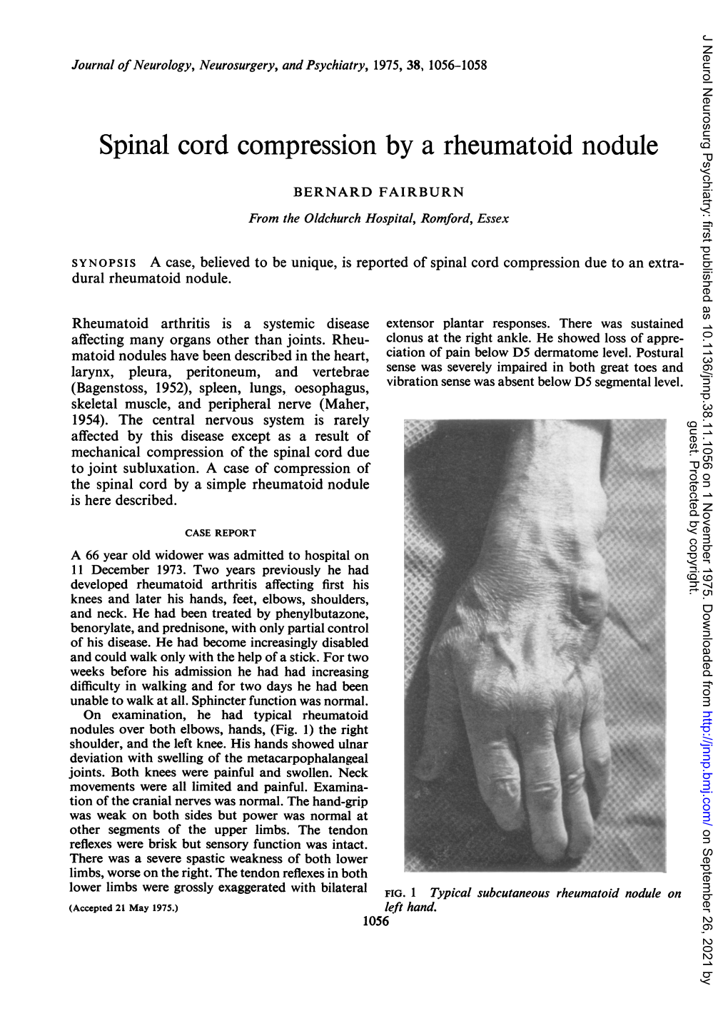 Spinal Cord Compression by a Rheumatoid Nodule
