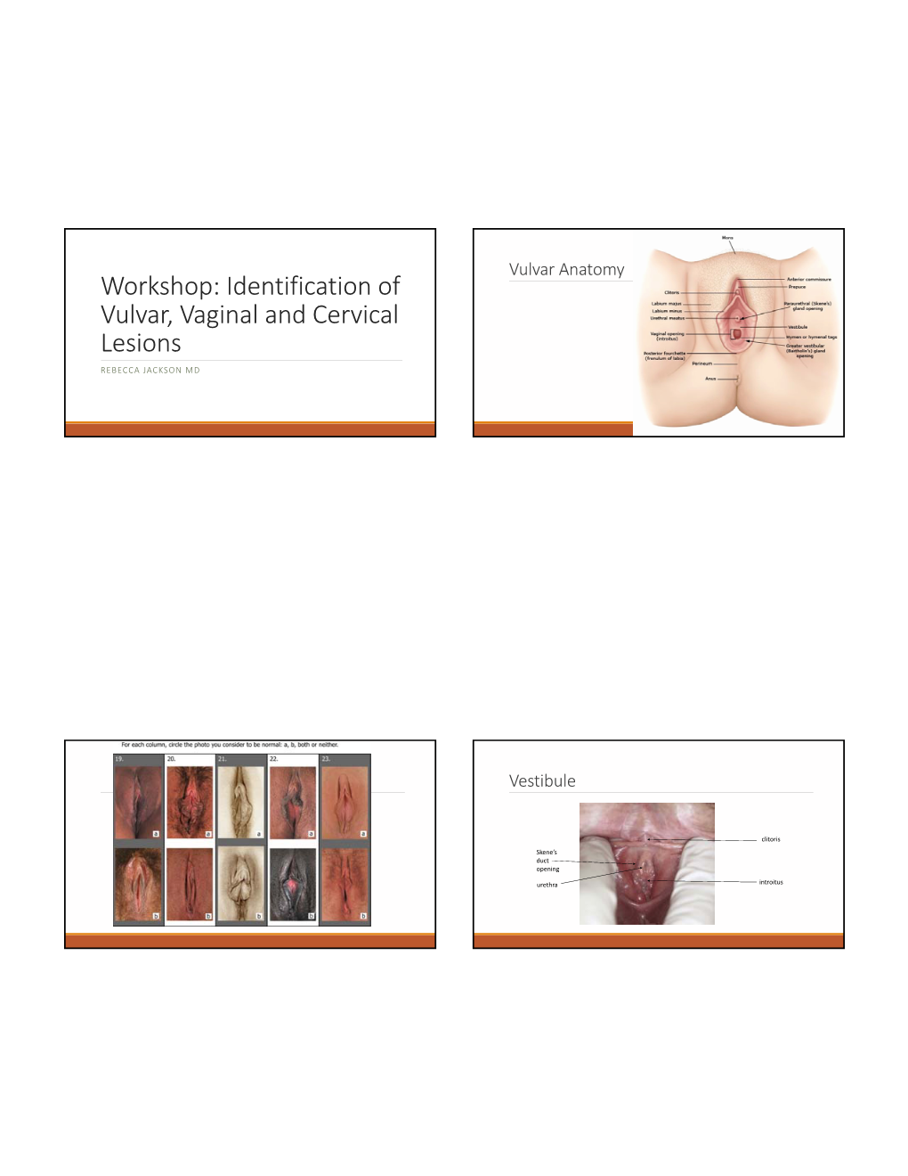 Workshop: Identification of Vulvar, Vaginal and Cervical Lesions REBECCA JACKSON MD