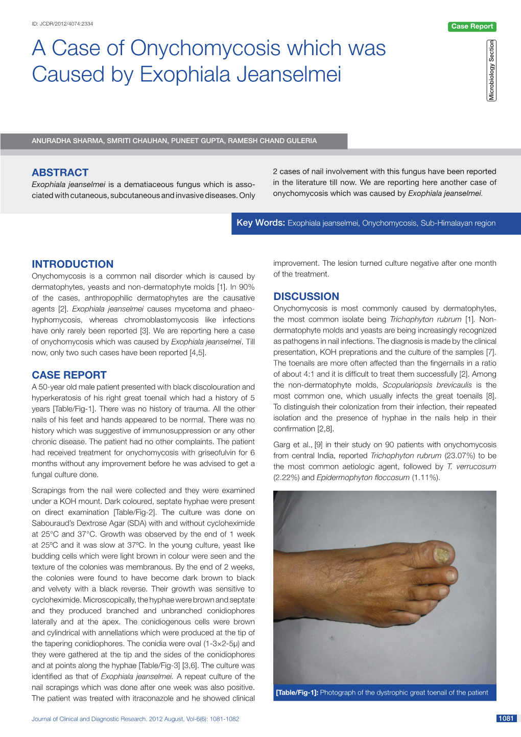 A Case of Onychomycosis Which Was Caused by Exophiala Jeanselmei Microbiology Section Microbiology