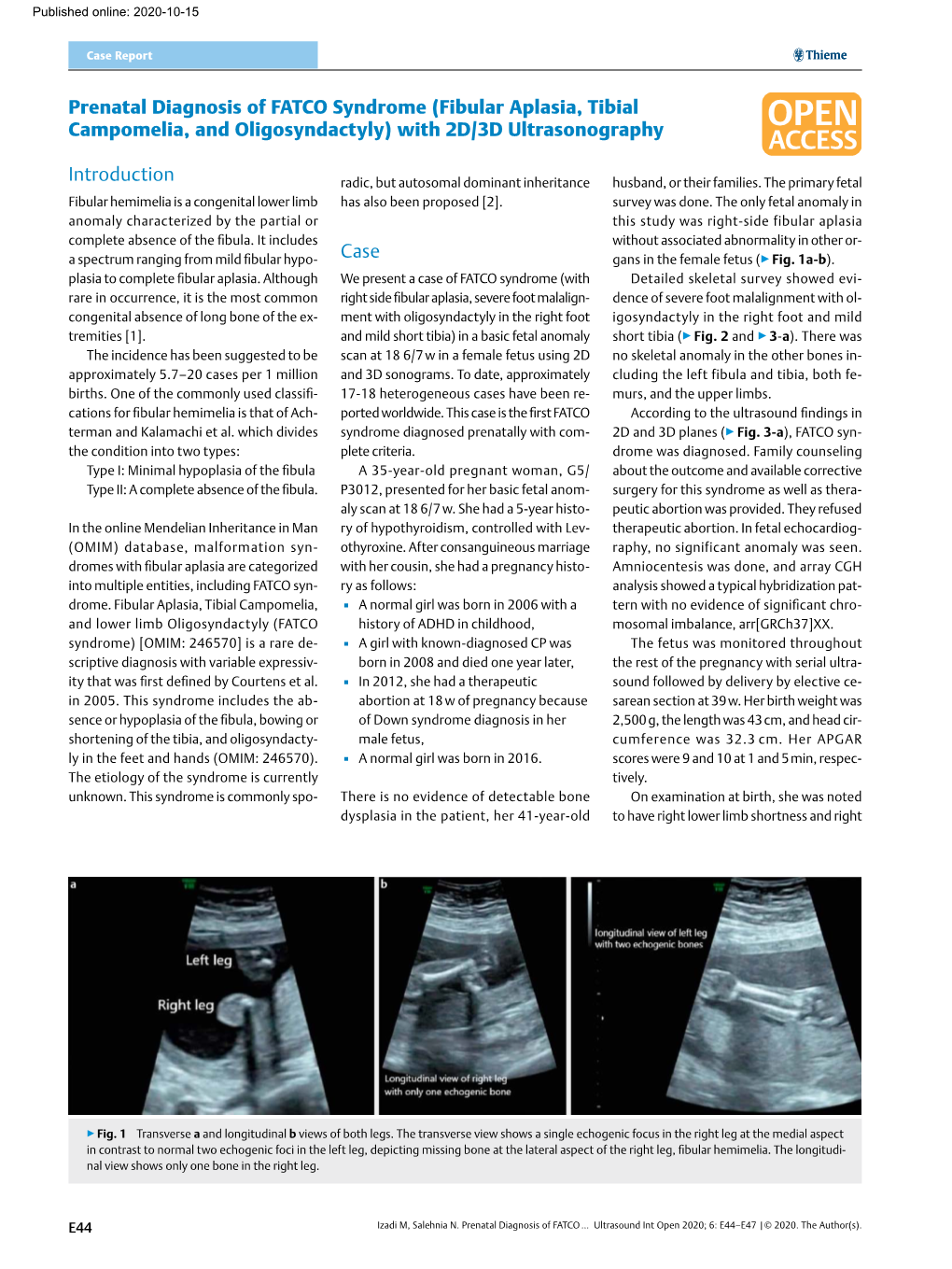 Prenatal Diagnosis of FATCO Syndrome (Fibular Aplasia, Tibial Campomelia, and Oligosyndactyly) with 2D/3D Ultrasonography