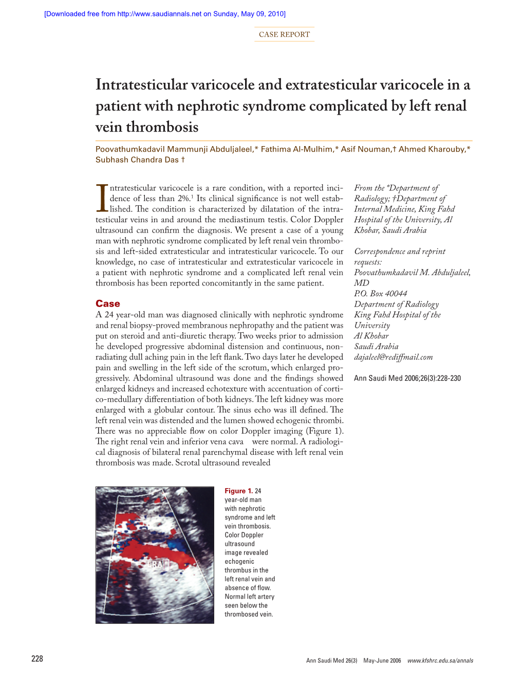 Intratesticular Varicocele and Extratesticular Varicocele in A