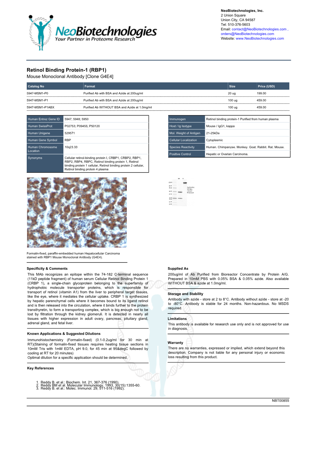 Retinol Binding Protein-1 (RBP1) Mouse Monoclonal Antibody [Clone G4E4]
