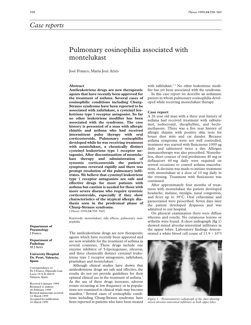 Case Reports Pulmonary Eosinophilia Associated with Montelukast