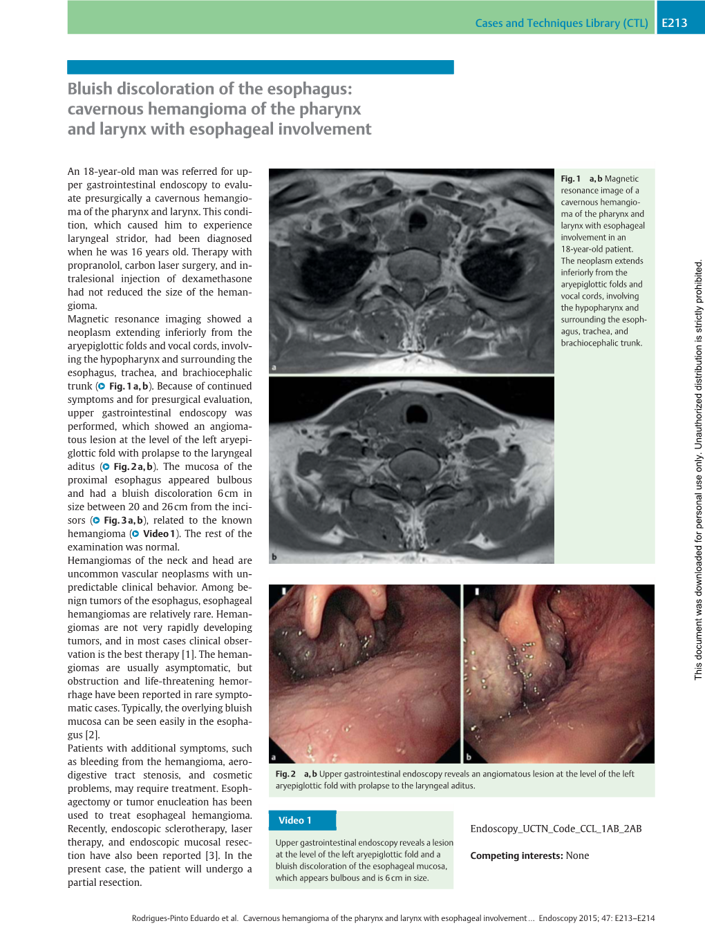 Bluish Discoloration of the Esophagus: Cavernous Hemangioma of the Pharynx and Larynx with Esophageal Involvement