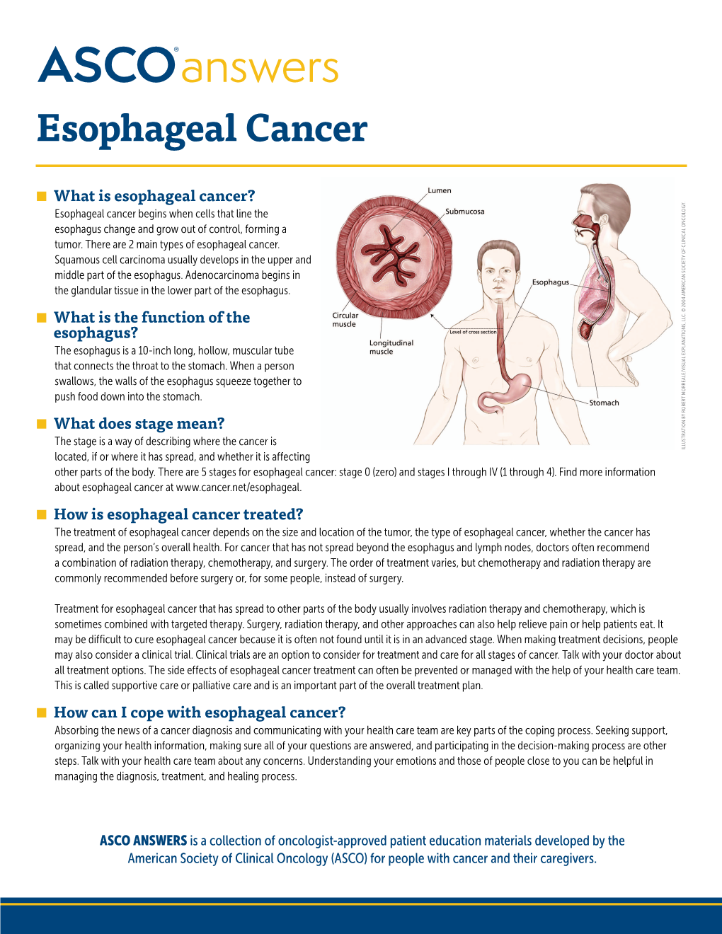 Esophageal Cancer