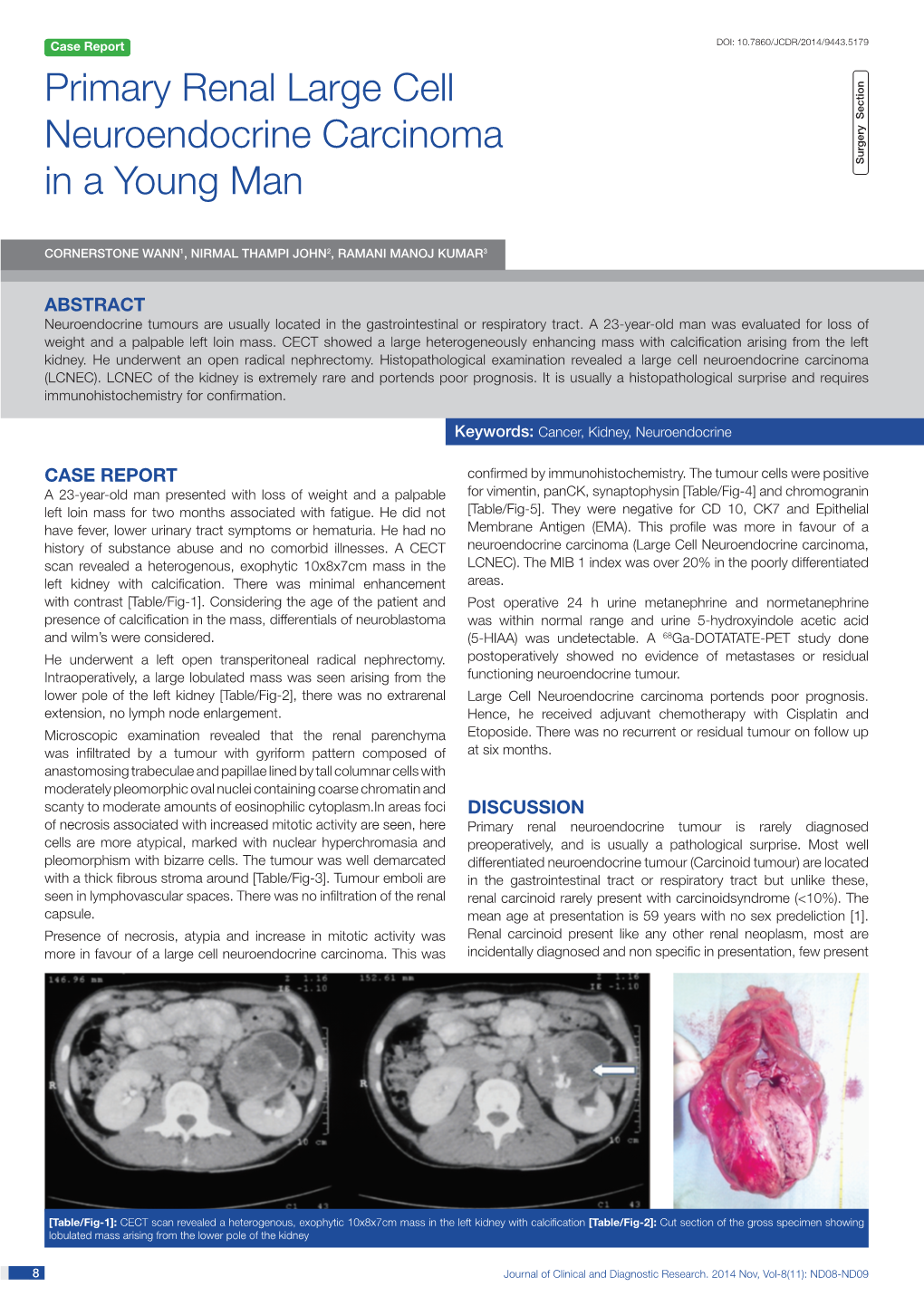 Primary Renal Large Cell Neuroendocrine Carcinoma in a Young Man Surgery Section