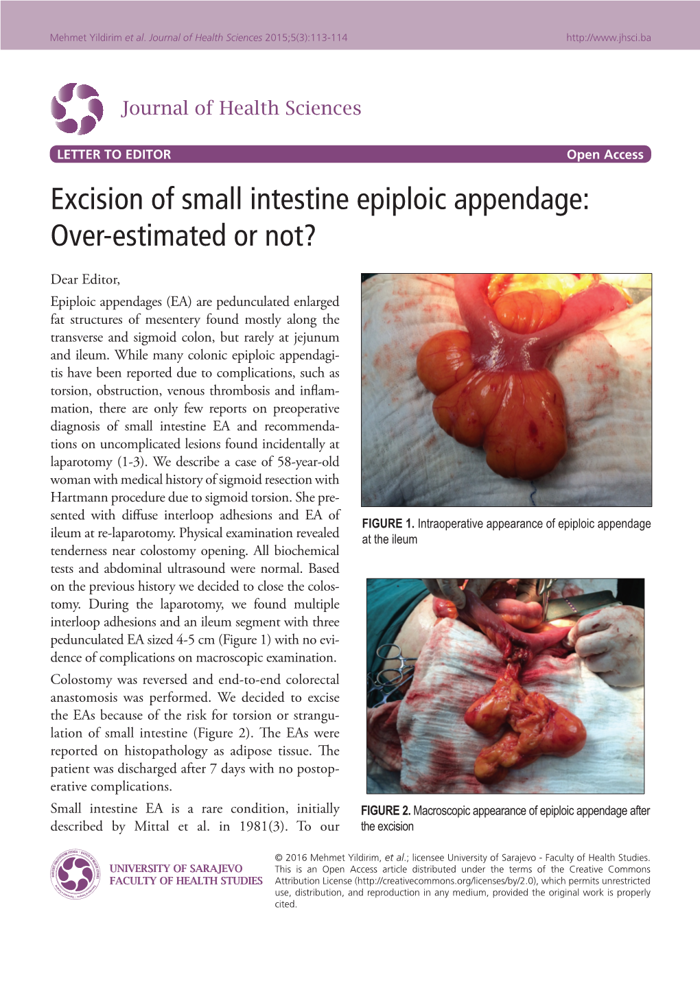 Excision of Small Intestine Epiploic Appendage: Over-Estimated Or Not?