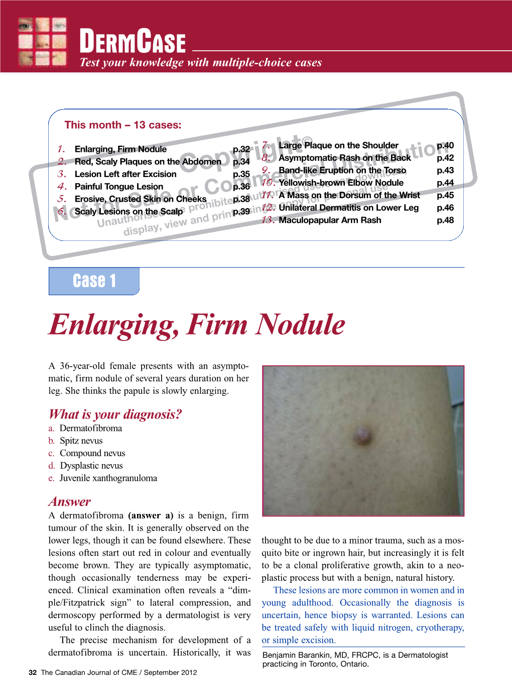 Enlarging, Firm Nodule P.32 7