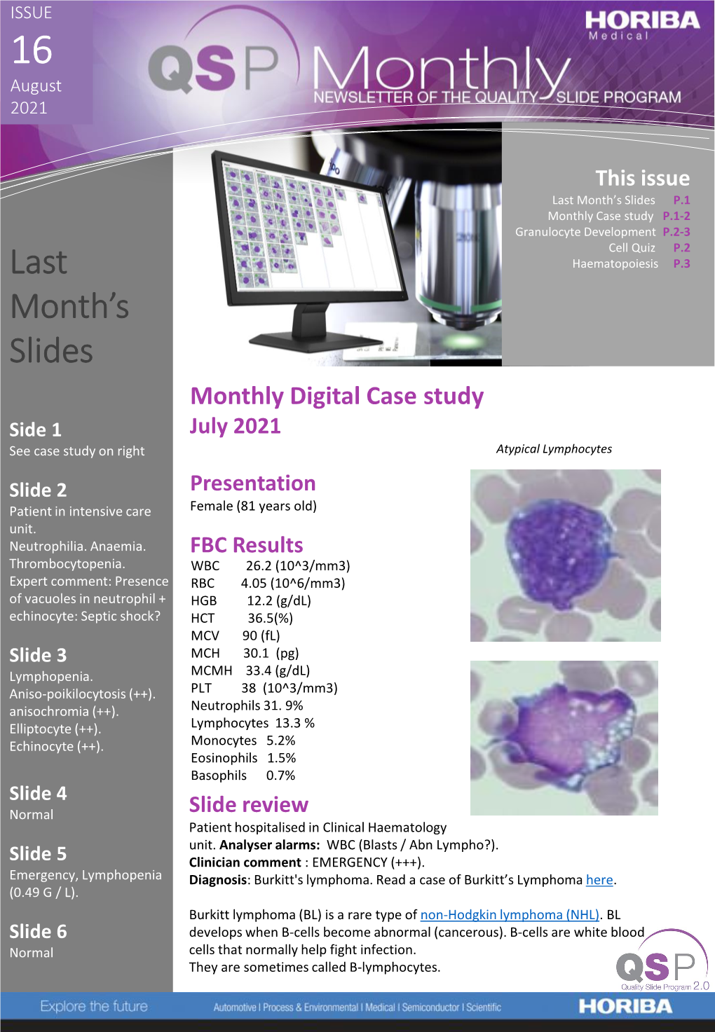 HORIBA Medical QSP Newsletter 16