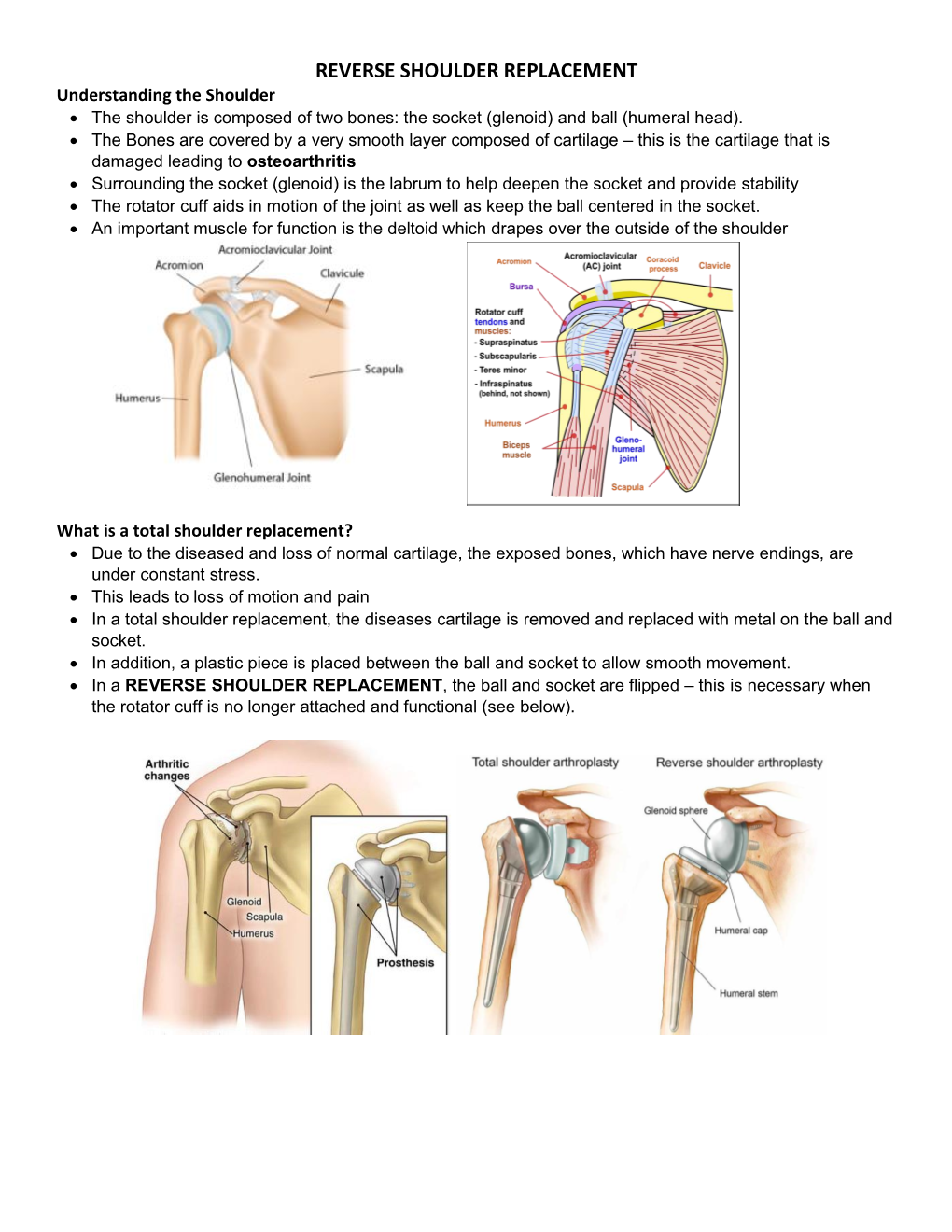 REVERSE SHOULDER REPLACEMENT Understanding the Shoulder • the Shoulder Is Composed of Two Bones: the Socket (Glenoid) and Ball (Humeral Head)