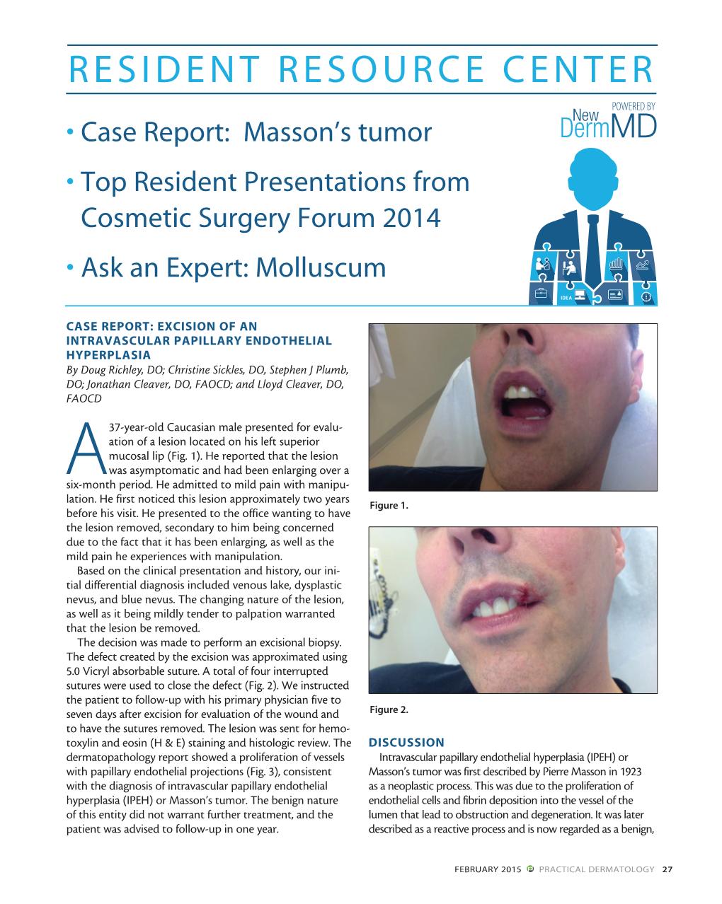 RESIDENT RESOURCE CENTER POWERED by • Case Report: Masson’S Tumor • Top Resident Presentations from Cosmetic Surgery Forum 2014 • Ask an Expert: Molluscum