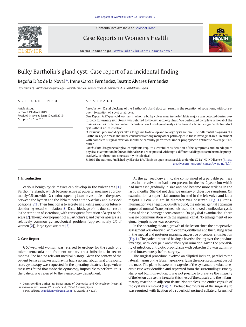 Bulky Bartholin's Gland Cyst: Case Report of an Incidental Finding