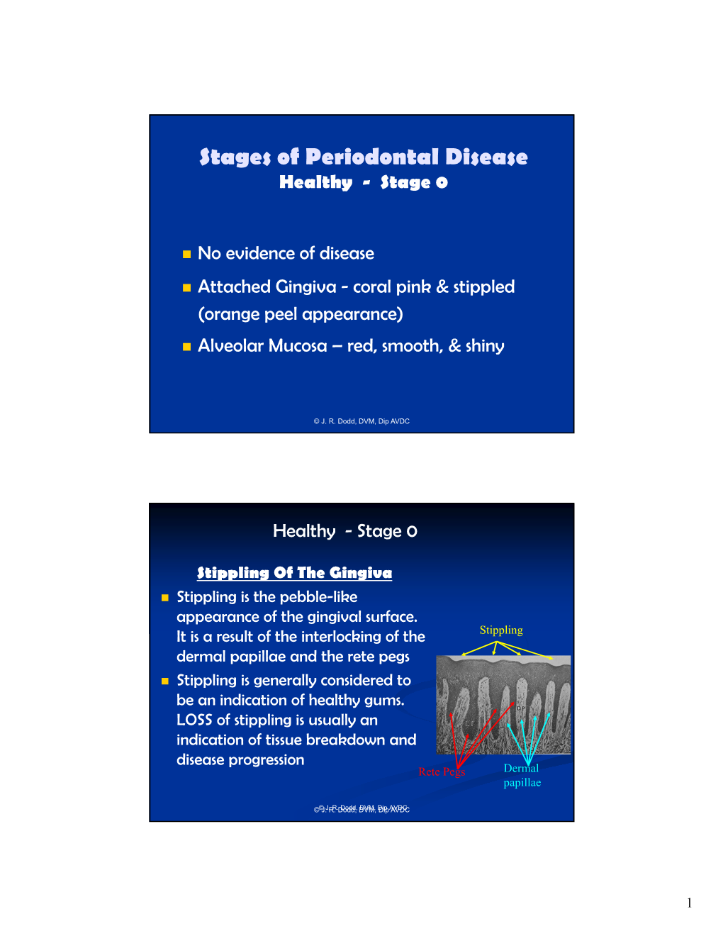 Stages of Periodontal Disease Healthy - Stage 0