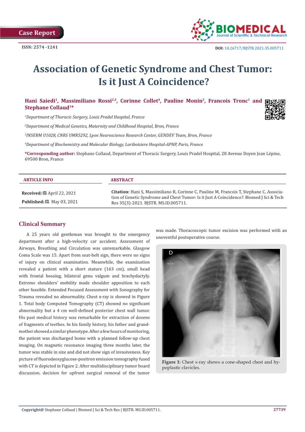 Association of Genetic Syndrome and Chest Tumor: Is It Just a Coincidence?