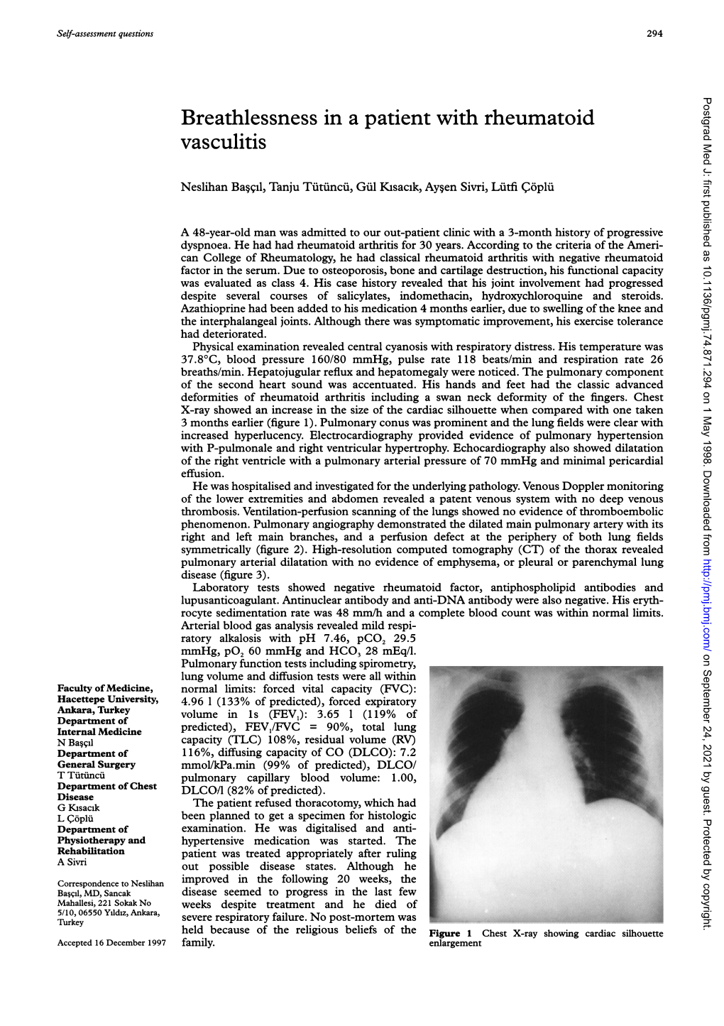 Breathlessness in a Patient with Rheumatoid Vasculitis