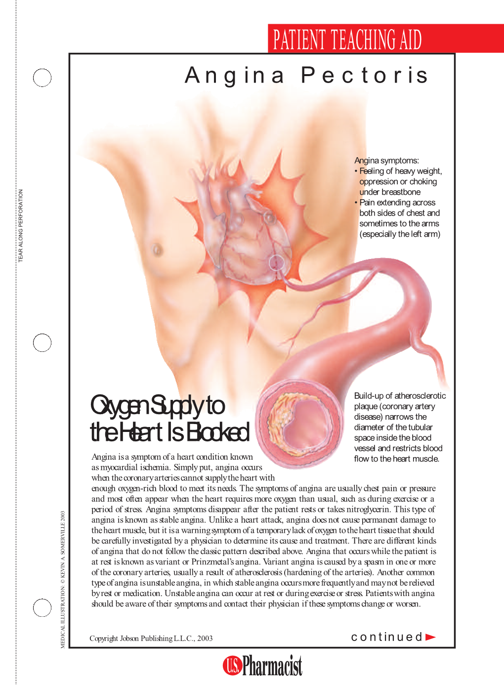 PTA Angina MAY 03 4/8LS