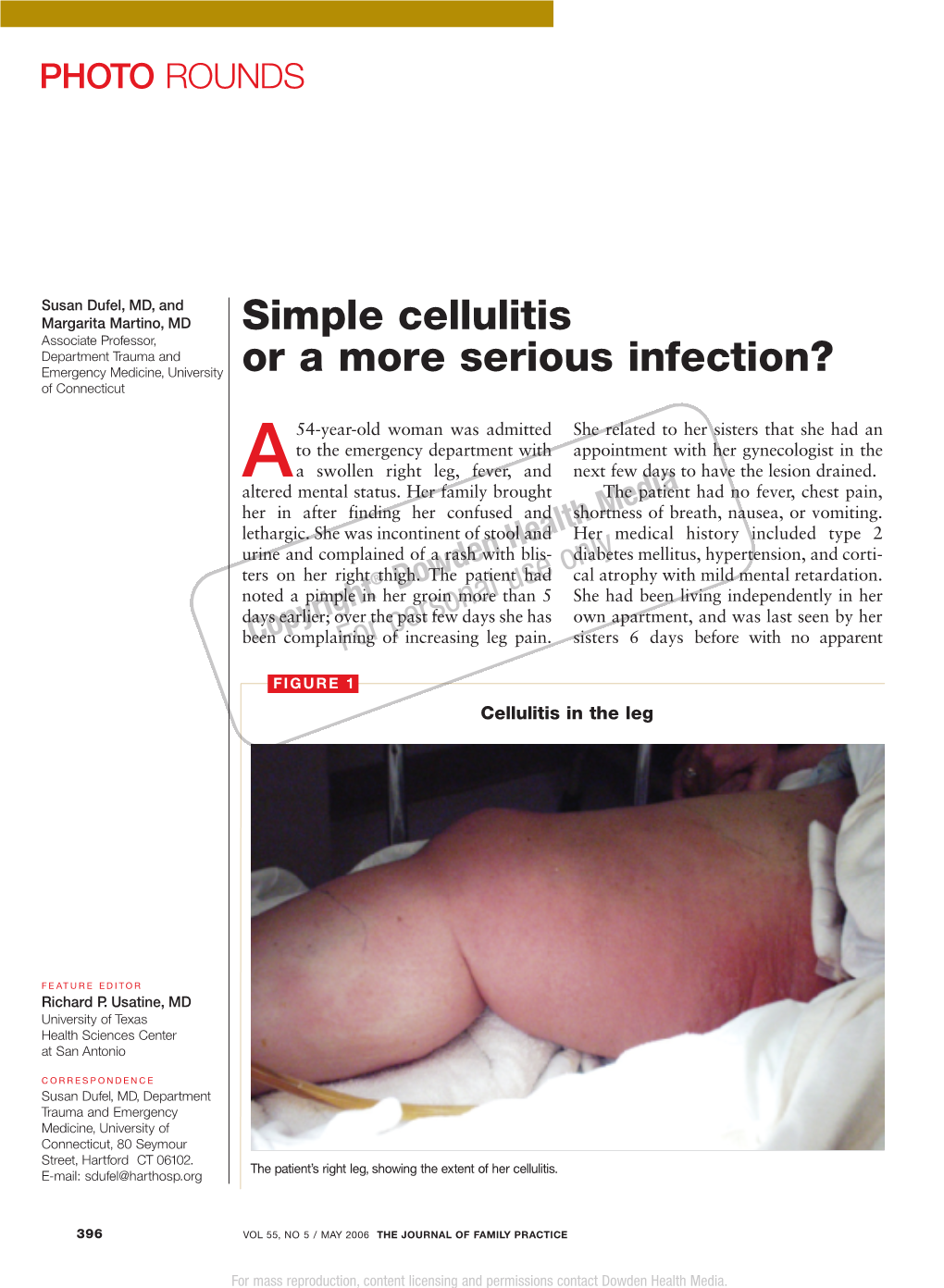 Simple Cellulitis Or a More Serious Infection? L