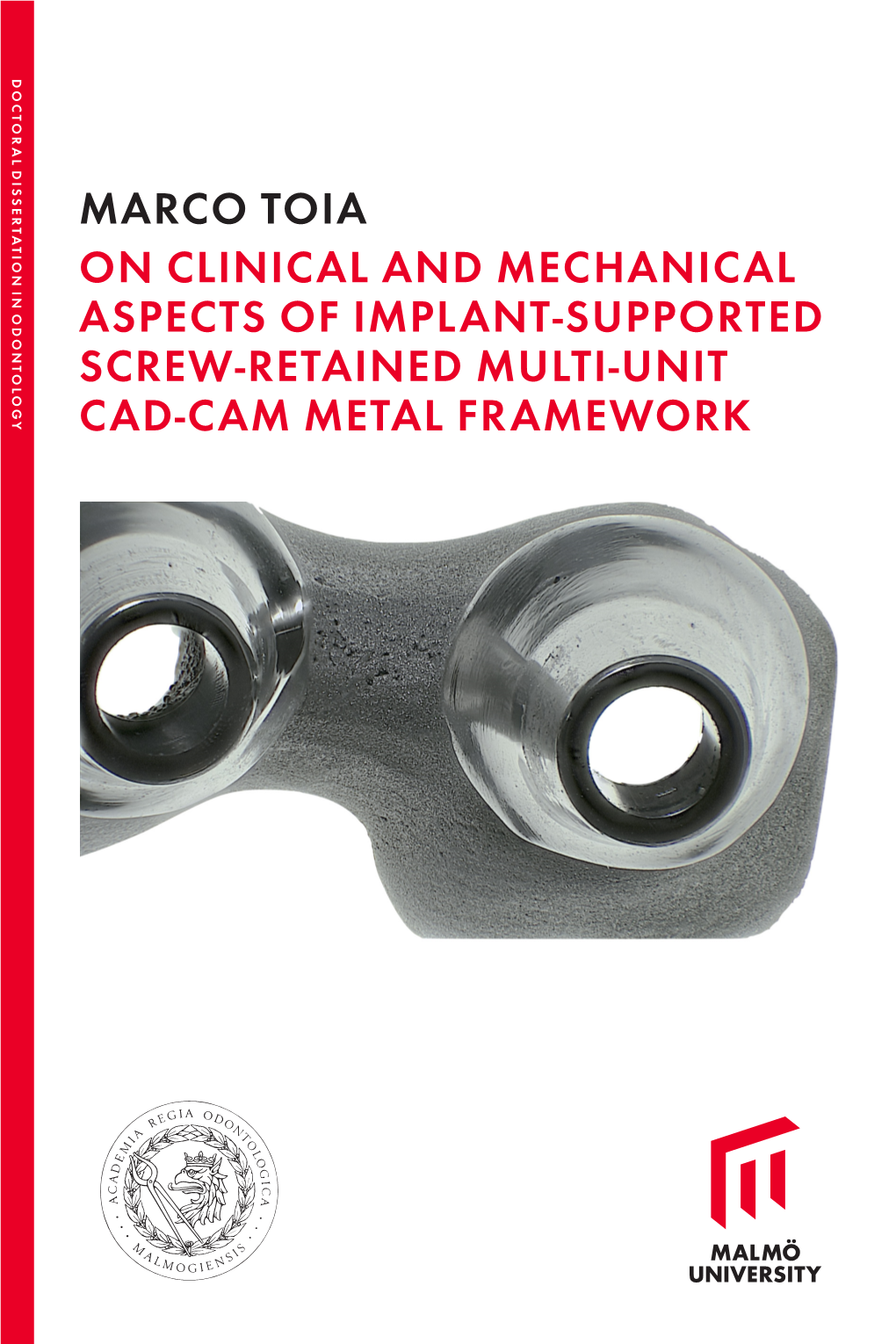 Marco Toia on Clinical and Mechanical Aspects of Implant-Supported Screw-Retained Multi-Unit Cad-Cam Metal Framework