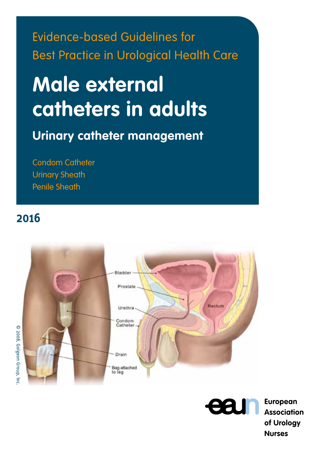 Male External Catheters in Adults Urinary Catheter Management