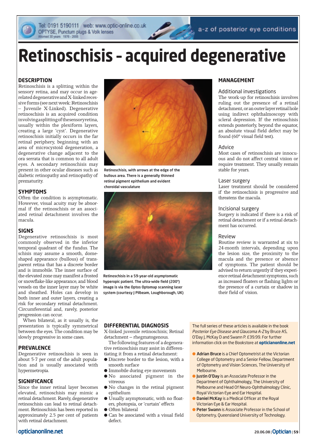 Retinoschisis – Acquired Degenerative