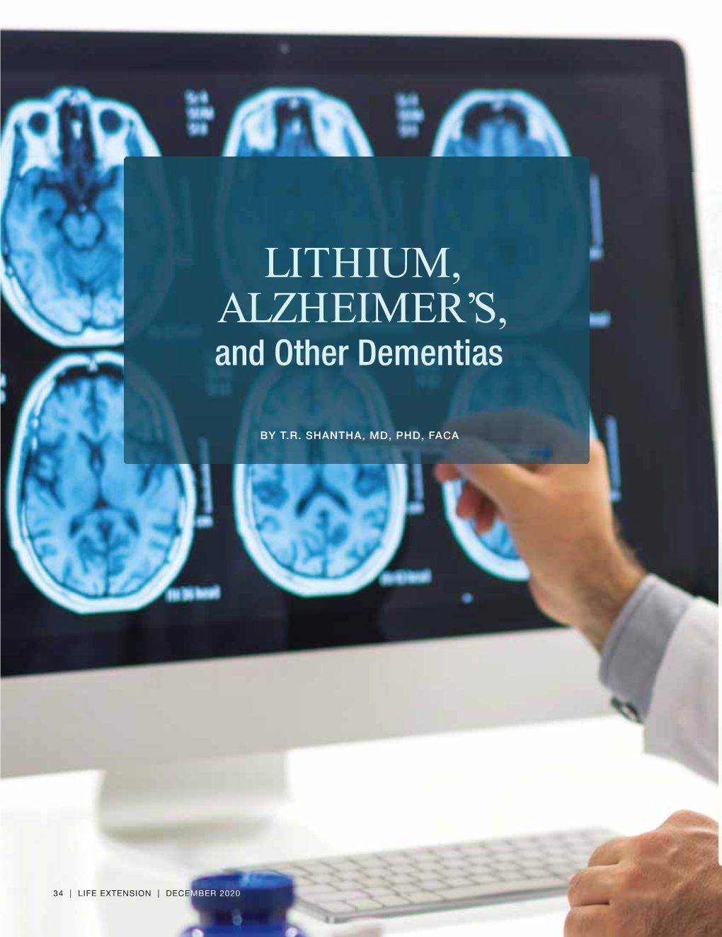LITHIUM, ALZHEIMER's, and Other Dementias