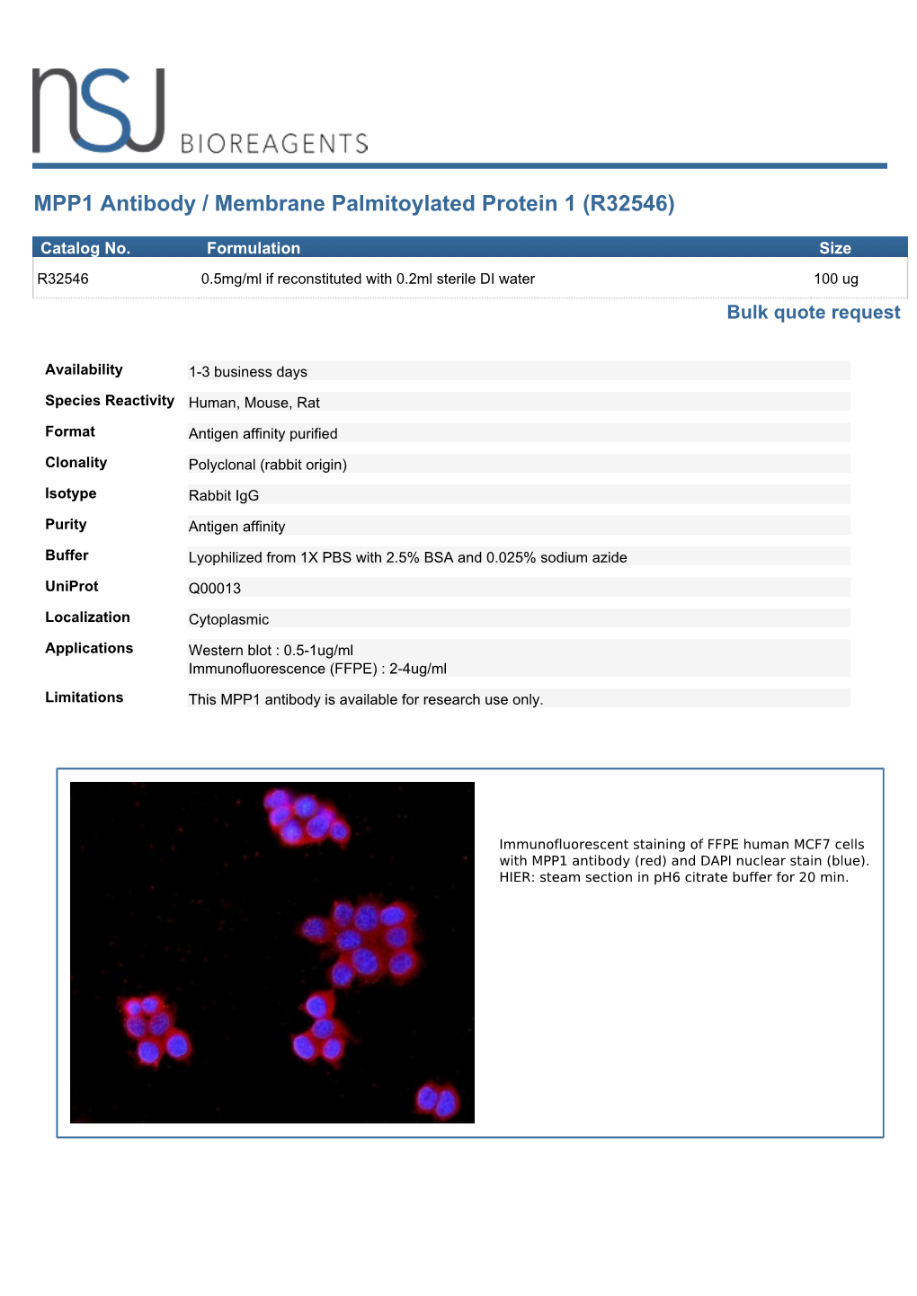 MPP1 Antibody / Membrane Palmitoylated Protein 1 (R32546)