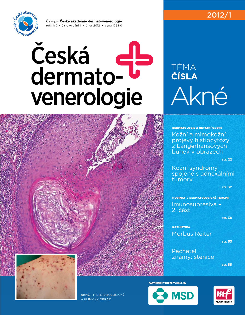 2012/1 Časopis České Akademie Dermatovenerologie Ročník 2 • Číslo Vydání 1 • Únor 2012 • Cena 125 Kč