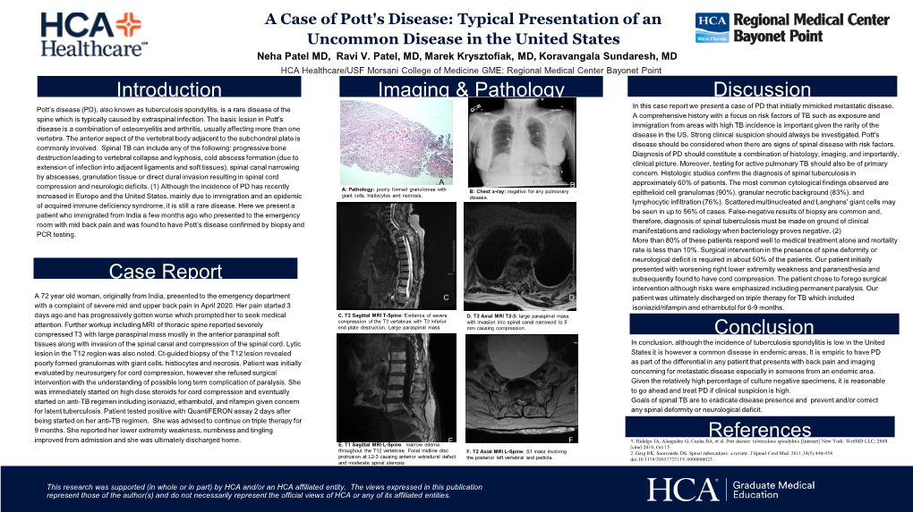 A Case of Pott's Disease: Typical Presentation of an Uncommon Disease in the United States Neha Patel MD, Ravi V