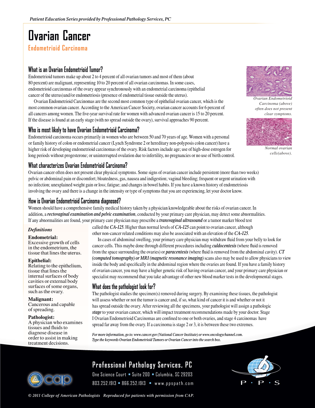 Ovarian Cancer Endometrioid Carcinoma