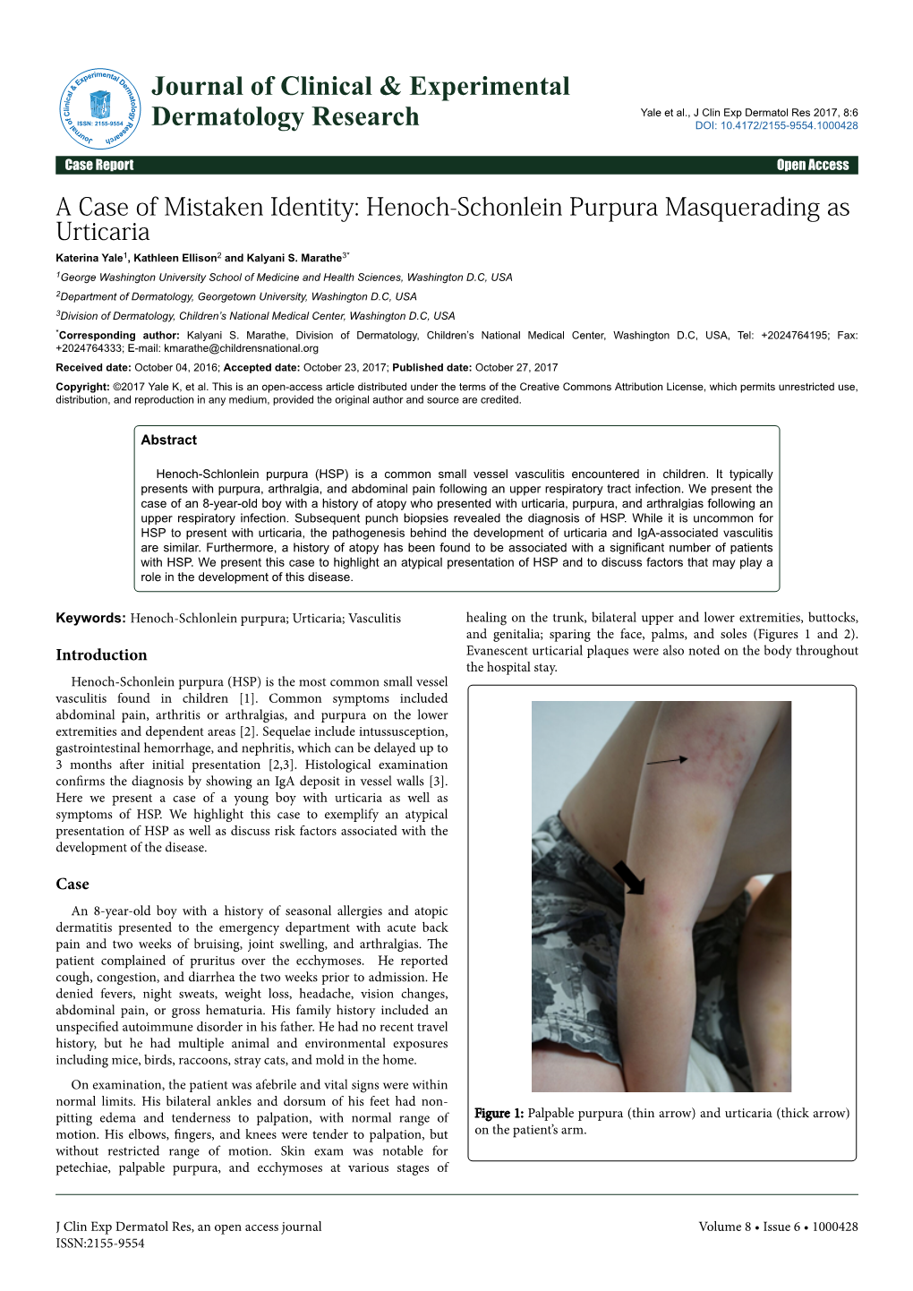 Henoch-Schonlein Purpura Masquerading As Urticaria Katerina Yale1, Kathleen Ellison2 and Kalyani S